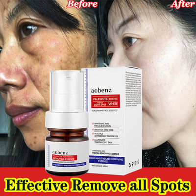 🔥【Limited time offer, buy 1 get 1 free, only $13 each】🔥Vitamin C Whitening Freckles Face Cream Remove Melasma Dark Spots Lighten Melanin