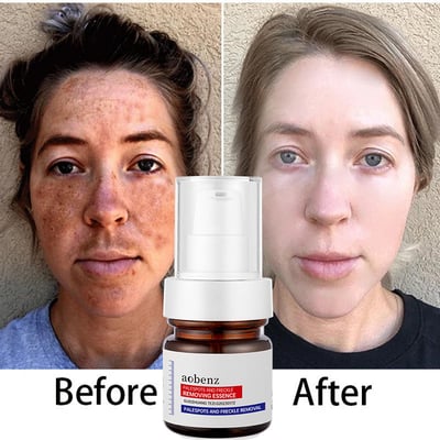 🔥【Limited time offer, buy 1 get 1 free, only $13 each】🔥Vitamin C Whitening Freckles Face Cream Remove Melasma Dark Spots Lighten Melanin