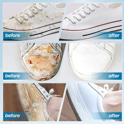 White Shoe Stain Remover