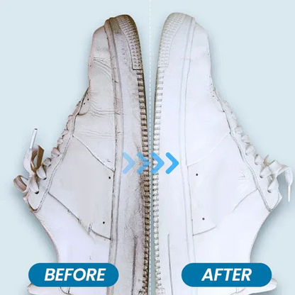 White Shoe Stain Remover