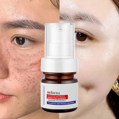 🔥【Limited time offer, buy 1 get 1 free, only $13 each】🔥Vitamin C Whitening Freckles Face Cream Remove Melasma Dark Spots Lighten Melanin