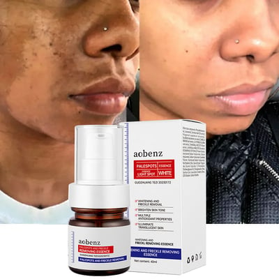 🔥【Limited time offer, buy 1 get 1 free, only $13 each】🔥Vitamin C Whitening Freckles Face Cream Remove Melasma Dark Spots Lighten Melanin